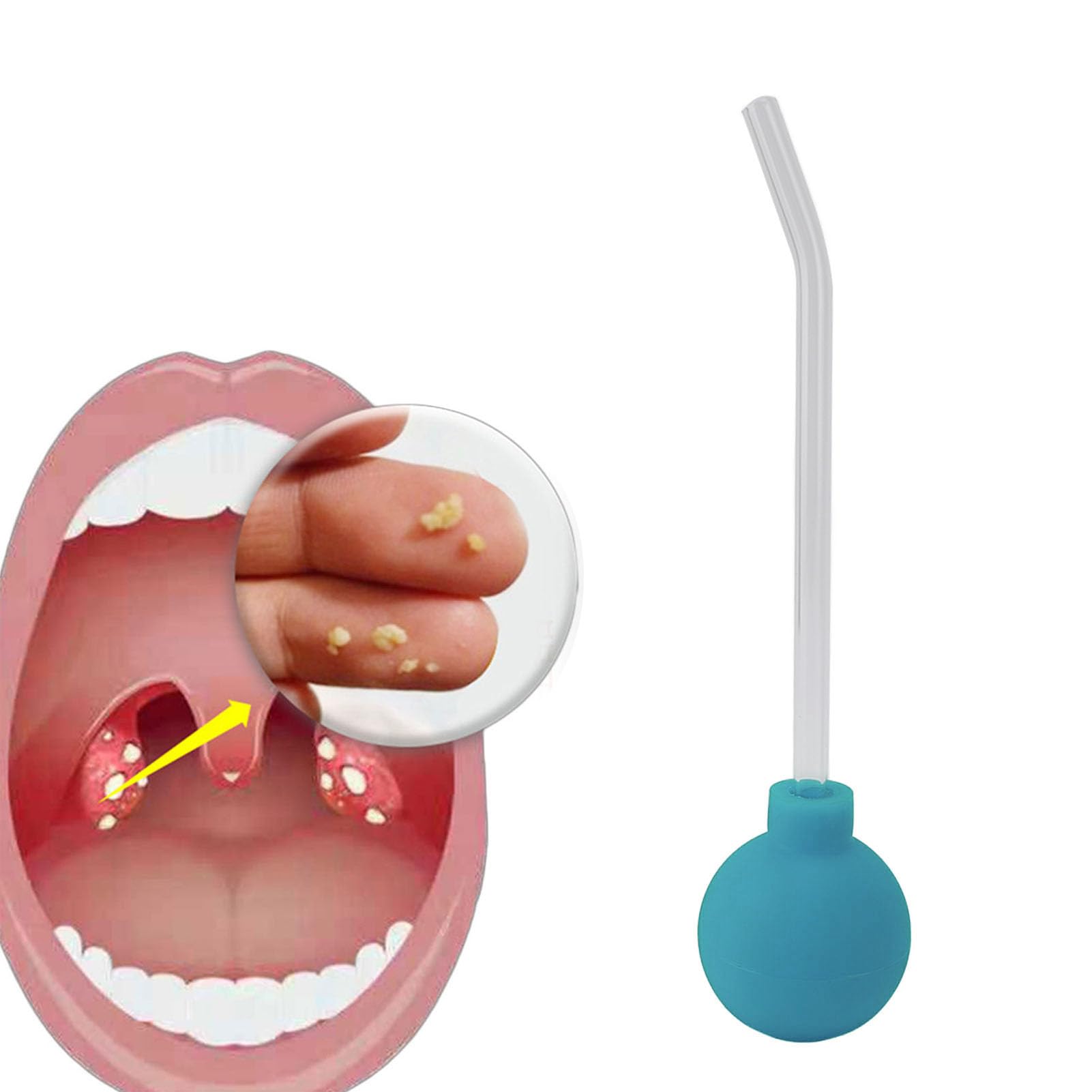 Tonsil Stone Remover,Tonsil Stone Remover Vacuum for Bad Breath Treatment,Tonsil Stone Suction Tool,Bad Breath Treatment for Adults,Throat Suction Tube Mouth Cleaner (Green)