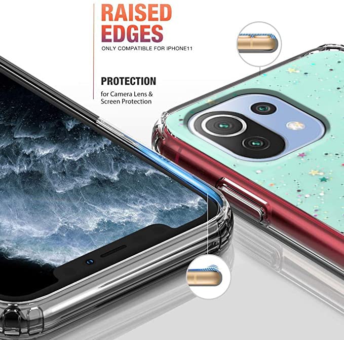 Handyhüllen Xiaomi Mi 11 Lite 5G - DeinDesign