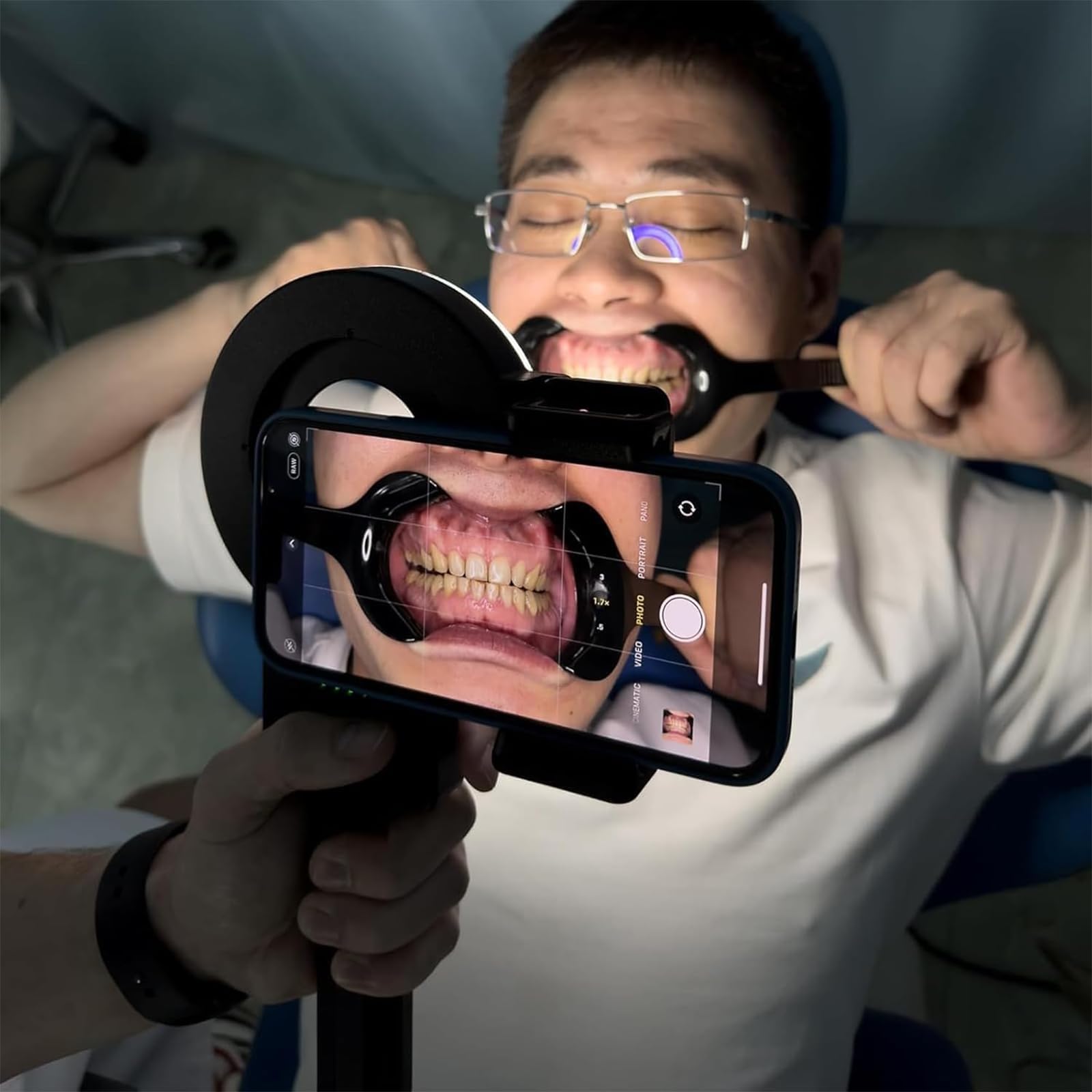 Ringlicht für zahnärztliche Fotografie mit 3 Modi und Farbtemperatur, 2500 K-6000 K, hocheffiziente Oralassistenzlampe für professionelle Fotoqualität