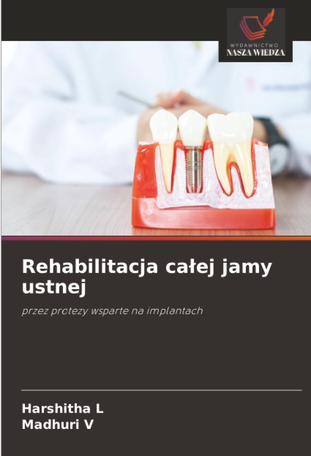 Rehabilitacja ca¿ej jamy ustnej: przez protezy wsparte na implantach