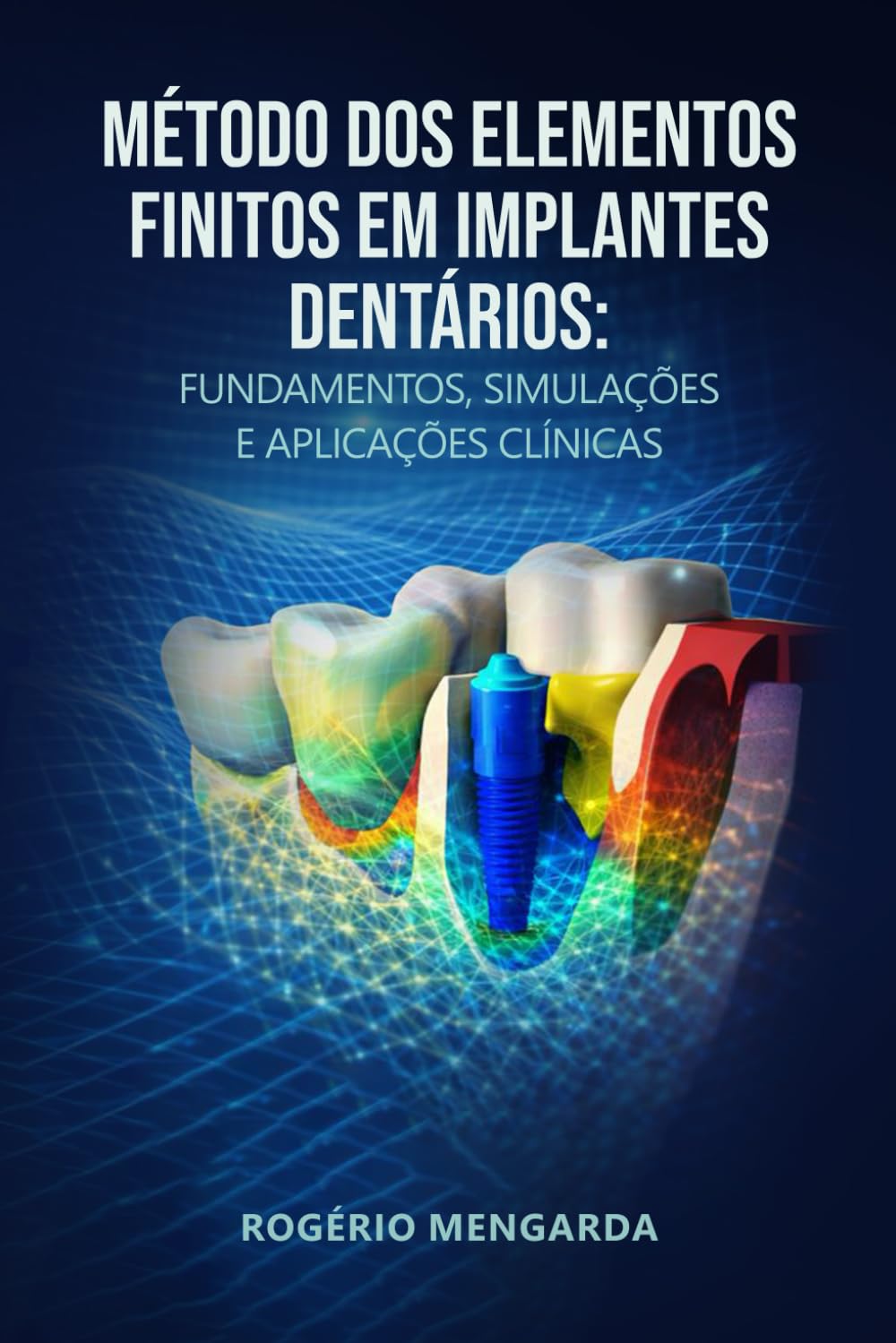 MÉTODO DOS ELEMENTOS FINITOS EM IMPLANTES DENTÁRIOS: FUNDAMENTOS, SIMULAÇÕES E APLICAÇÕES CLÍNICASMÉTODO DOS ELEMENTOS FINITOS EM IMPLANTES DENTÁRIOS