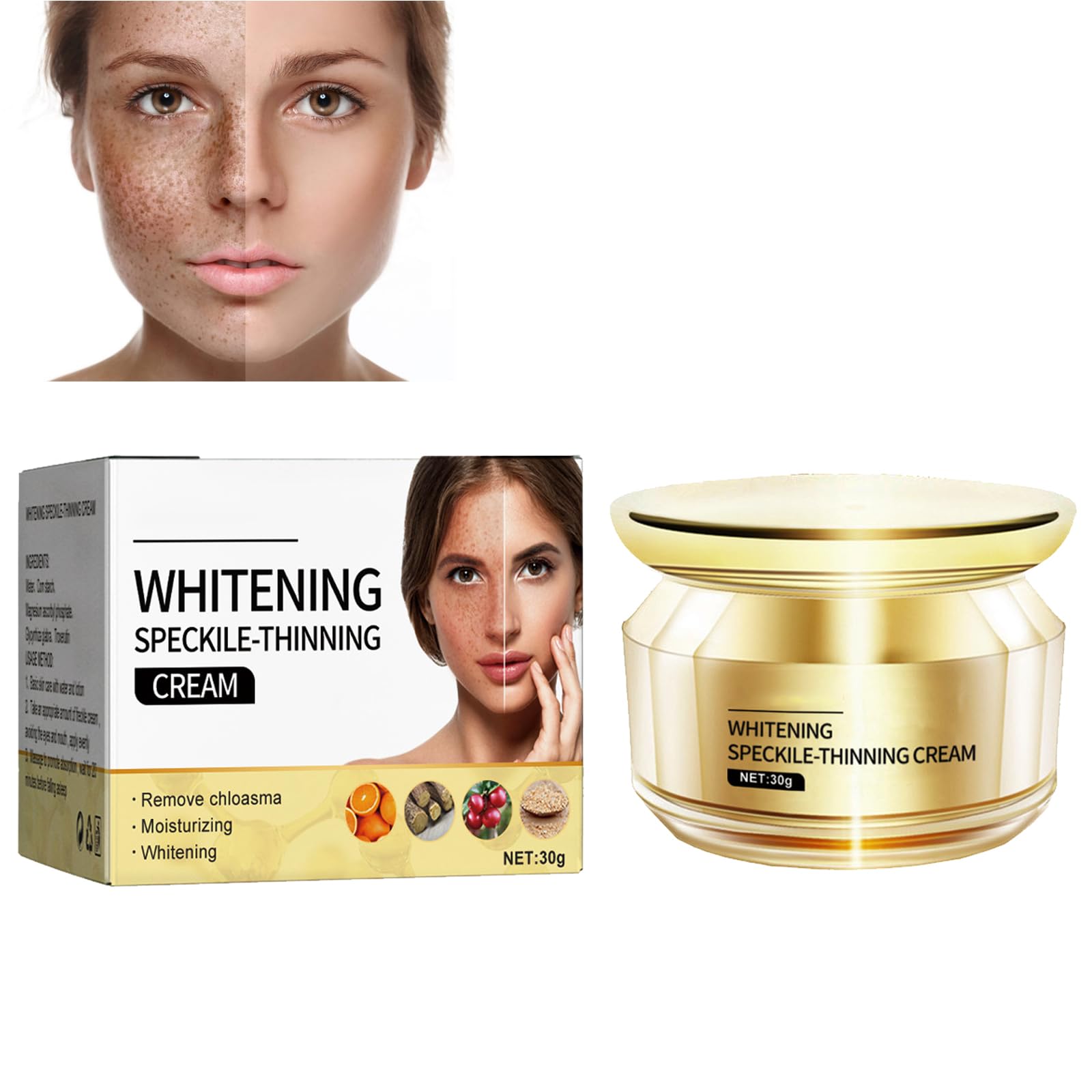 KOAHDE Whitening Freckle Cream,Facial Spot Removing Cream,Moisturizing Anti-Blemish,Spot Lighteningfor Face,Dark Spots Remover Skin