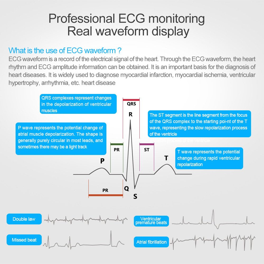 ECG Portatile a 3 Derivazioni con Analisi Algoritmica – 22 Ore di Registrazione Continua, Schermo LCD, Metodi Di Misurazione Rapida (Palmo/Gamba/Torace) in 30 Secondi, 17 Risultati Di Misurazione