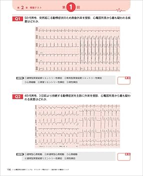 61UE9m8Y-WL._AC_UF350,