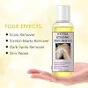 Peeling Oil, Lightening Exfoliat-ing Dark Skin For Body, Skin Peeling Oil For Skin Lightening, Ffective Gentle Body Exfoliate Extra Strength Whitening, Peeling Solution Dark Skin, 110ml