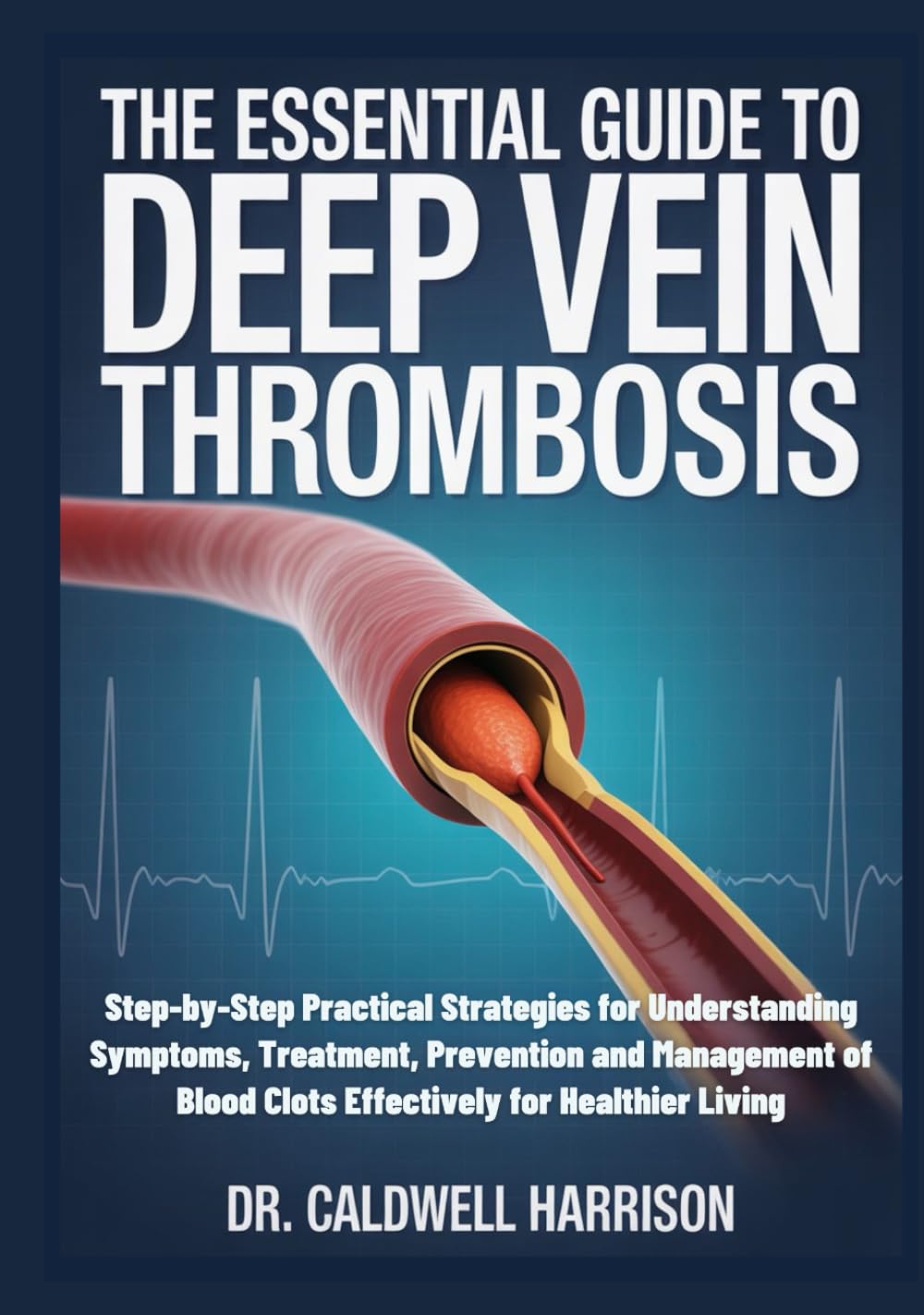 The Essential Guide to Deep Vein Thrombosis: Step-by-Step Practical Strategies for Understanding Symptoms, Treatment, Prevention and Management of Blood Clots Effectively for Healthier Living