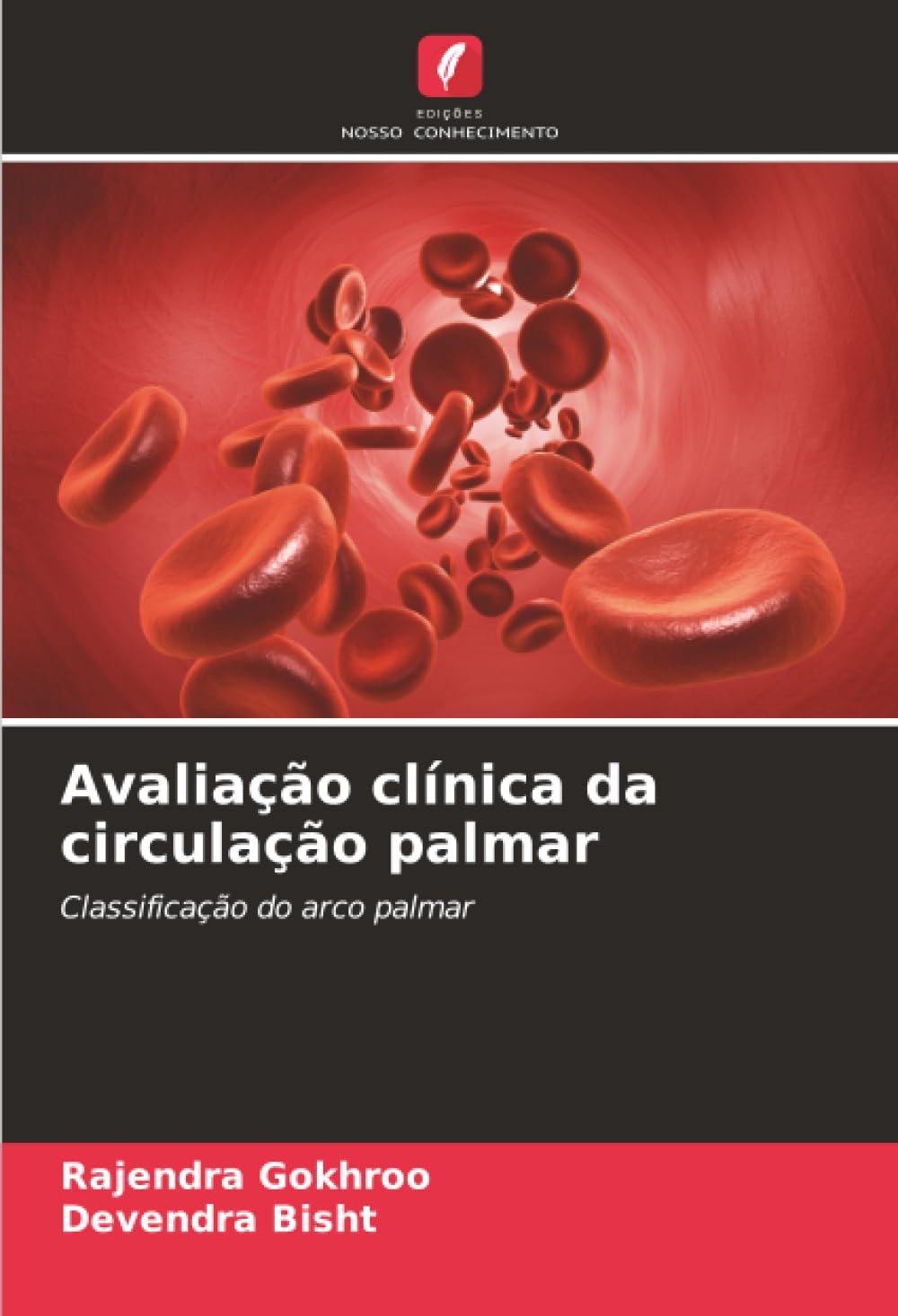 Avaliação clínica da circulação palmar: Classificação do arco palmar