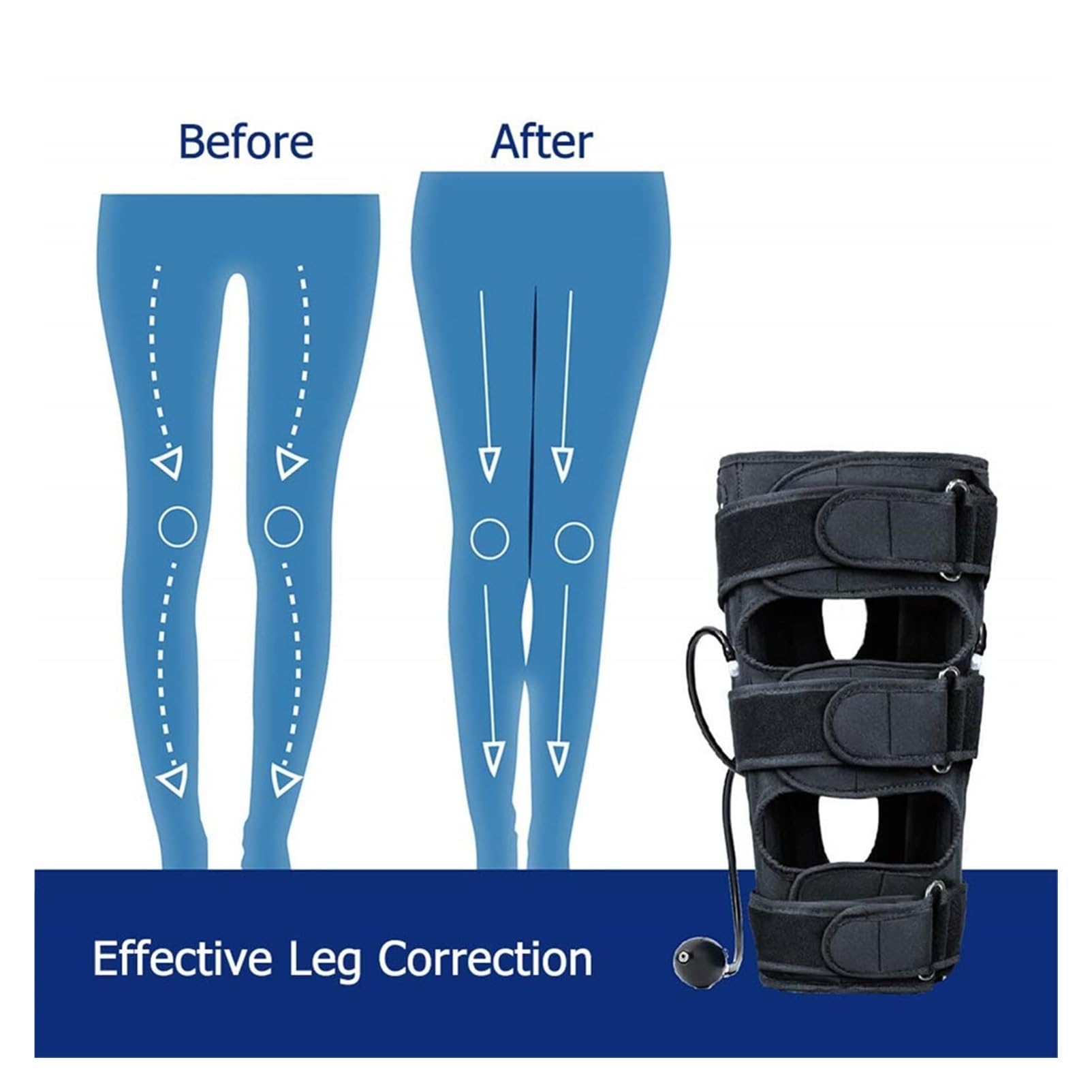 Corrector de piernas arqueadas y rodillas valgas｜Faja correctora piernas X/O regulable para niños y adultos con soporte aluminio extraíble y compresión doble bolsa de aire