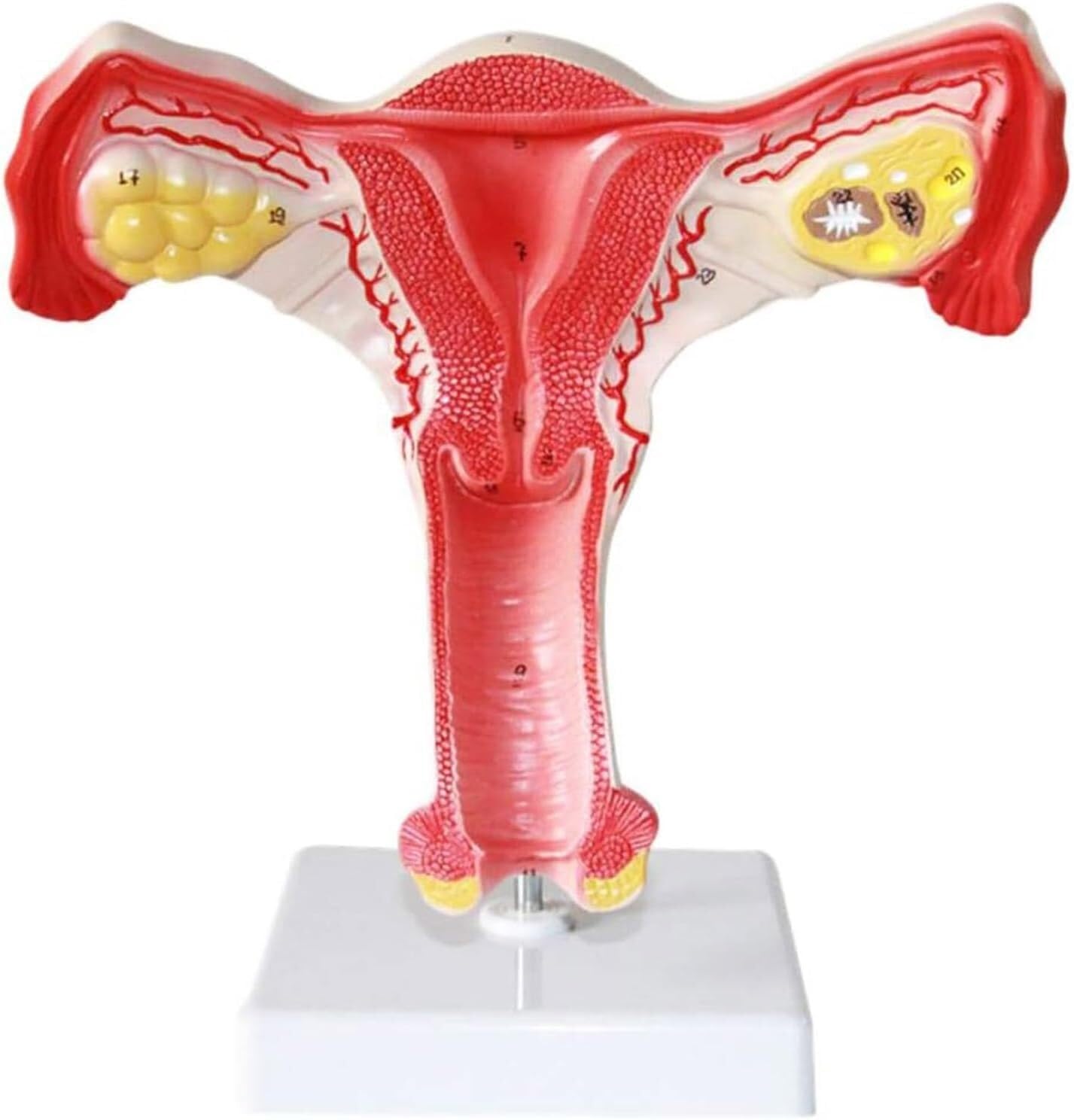 Modelo anatómico de anatomía, lesión uterina, Modelo de anatomía de órganos Humanos con órganos extraíbles para la enseñanza, Aprendizaje y exhibición de órganos.