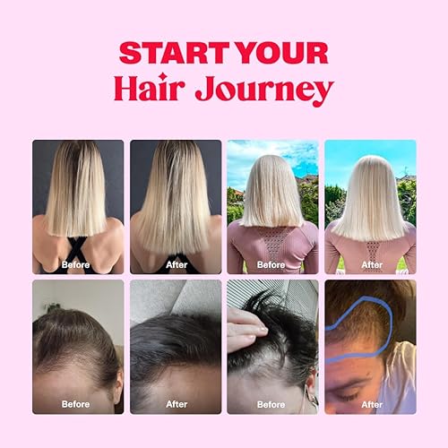 Miniatura 9 de Bloom Robbins Vitaminas prenatales en gomitas para el cabello para mujeres embarazadas con vitamina B6  Multivitamínico prenatal para mujeres y