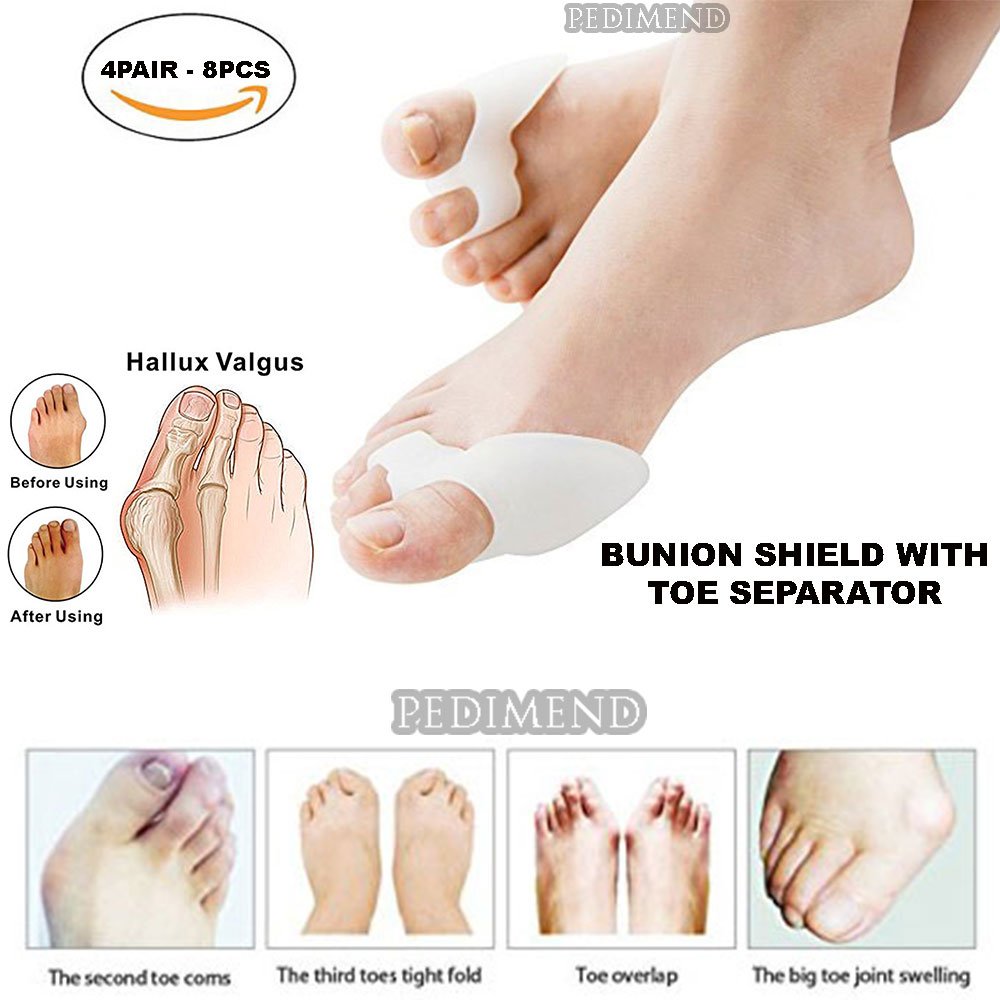 Pedimend Silicone Gel Toe Separator (8 PCs) to Align Toes - Bunion Toe Treatment, Big Toe Straightener, Toe Cushion, Avoid Friction Shoes - Toe Alignment Support – UNISEX - Foot Care