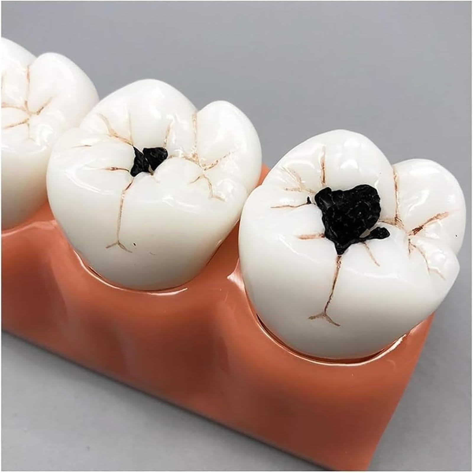 Standardowy model zębów dla dorosłych dentystów, realistyczny projekt symulacji i doskonałe wykonanie do nauczania, akcesoria do próchnicy zębów dla dentystów, nauczycieli uczniów nauczania anatomii
