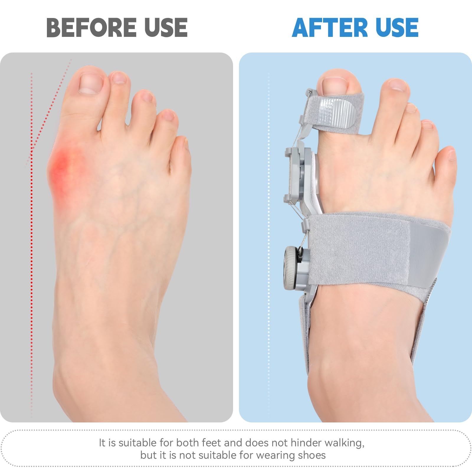 BORT PediSoft Ballenschutz