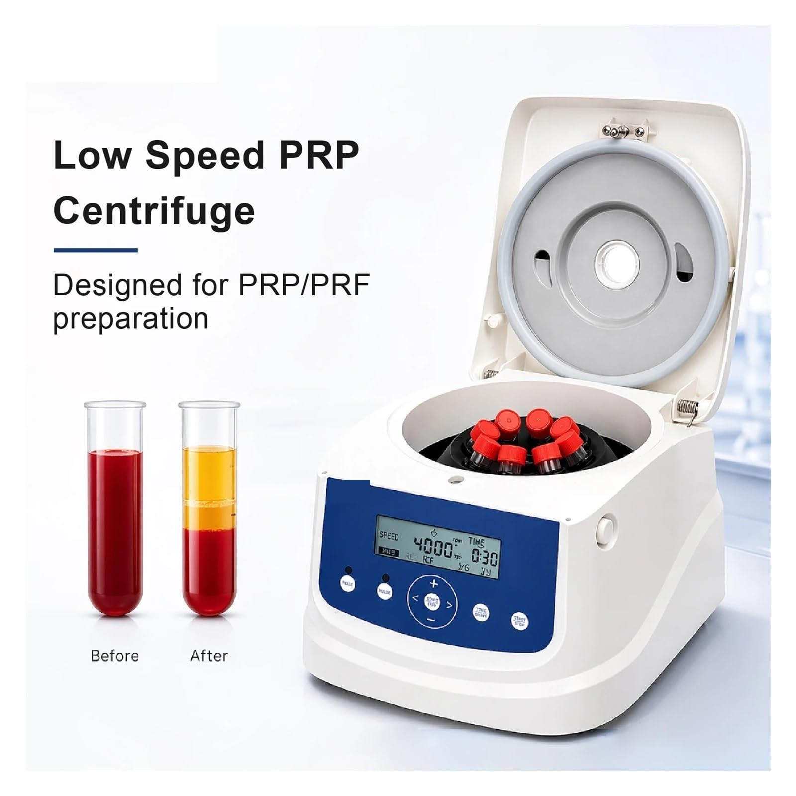 Centrífuga de mesa, Q0408E PRP Centrifuge Lab Separador De Baja Velocidad Temporizado 4000 Rpm 8x15 Ml Laboratorio Separación Sangre