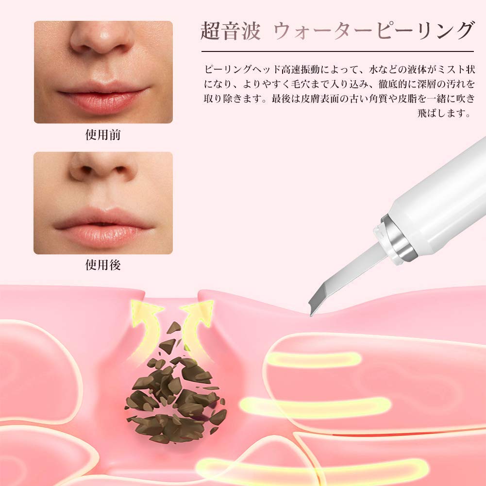 Amazon.co.jp: ZumYu ウォーターピーリング 超音波美顔器 超音波