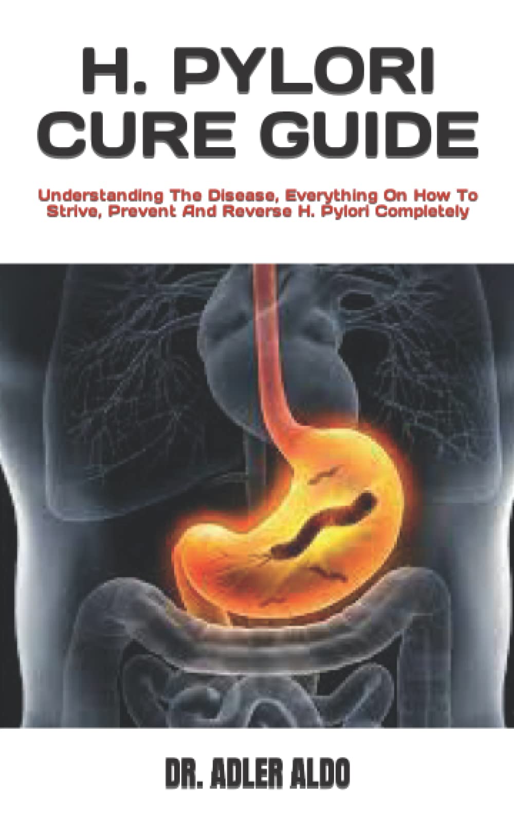 Buy H. PYLORI CURE GUIDE Understanding The Disease, Everything On How To Strive, Prevent And