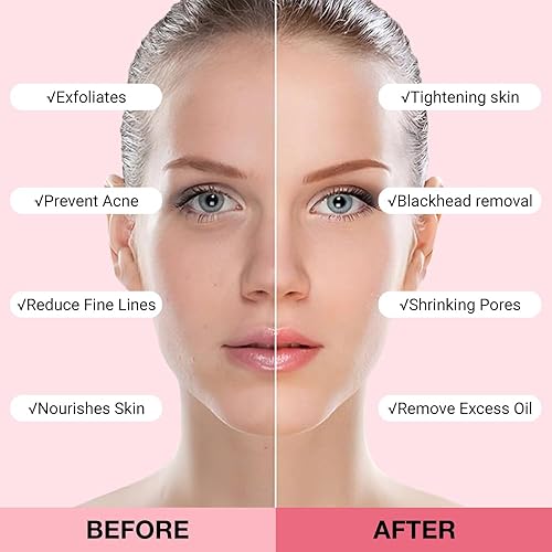 Miniatura 4 de 2 máscaras de arcilla para cara, removedor de puntos negros para cara, limpieza profunda de poros, hidratante, cuidado de la piel para refinar poros