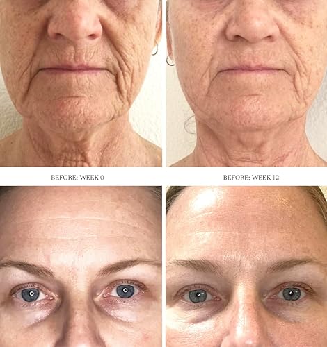 Miniatura 2 de City Beauty Concentrado exfoliante Dermal Reset - Exfoliante facial diario de ácido láctico AHA - Solución para arrugas, textura, decoloración y