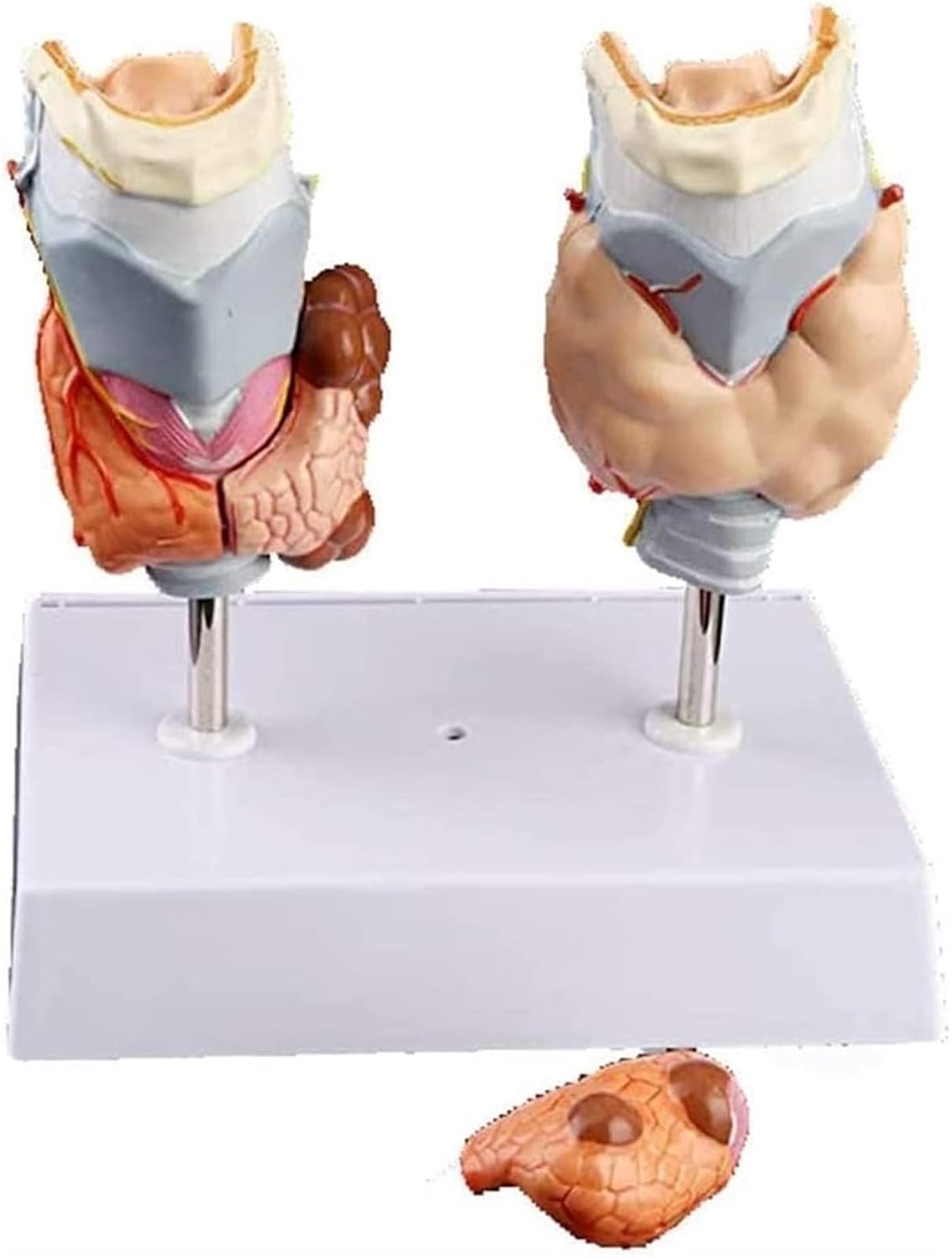 Anatomy Models, Thyroid Pathology, Medical Education Teaching Aids