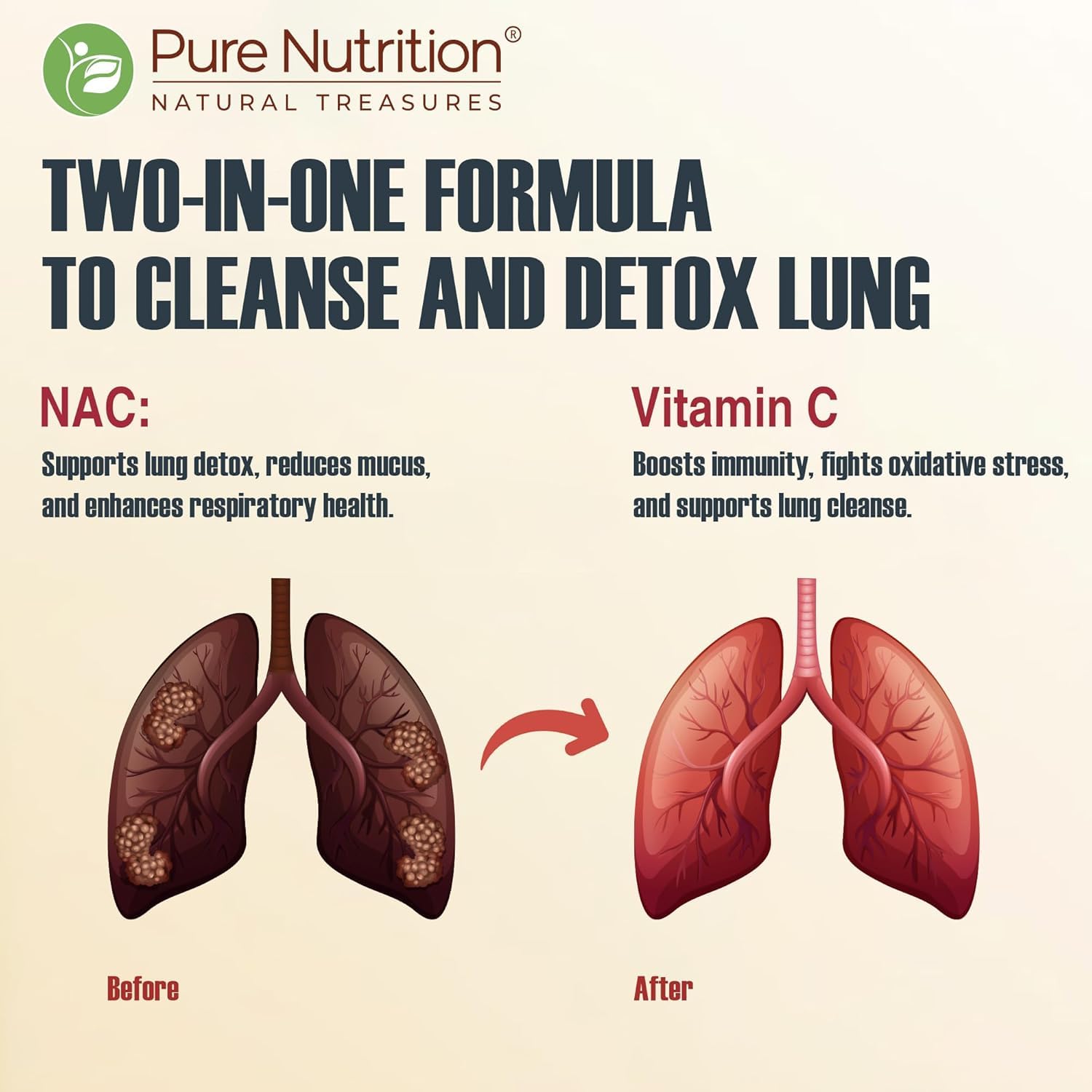 PURE NUTRITION NATURAL TREASURES Lung Detox 20 Effervescent Tablets (Lemon Flavor) With N-Acetylcysteine 600 Mg And Vitamin C |Removes Tar & Support Respiratory Health 2