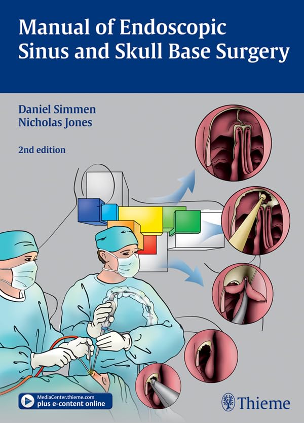 Manual of Endoscopic Sinus and Skull Base Surgery (English Edition)