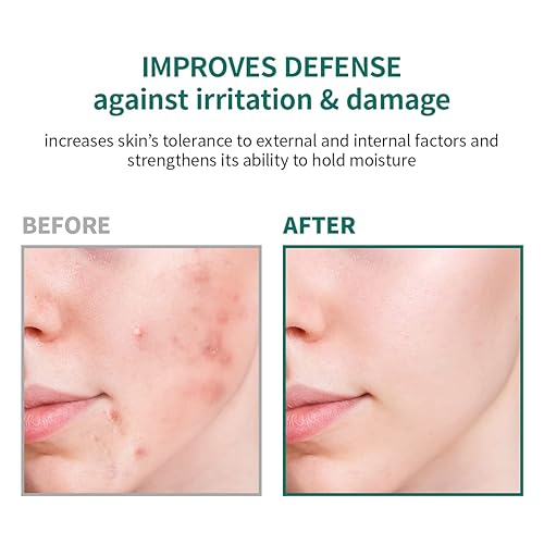 Miniatura 4 de Jaminkyung Paquete de máscara de terapia de manchas Centella de 088 onzas 088oz x 5 unidades Centella asiática suave reafirmante protección de la