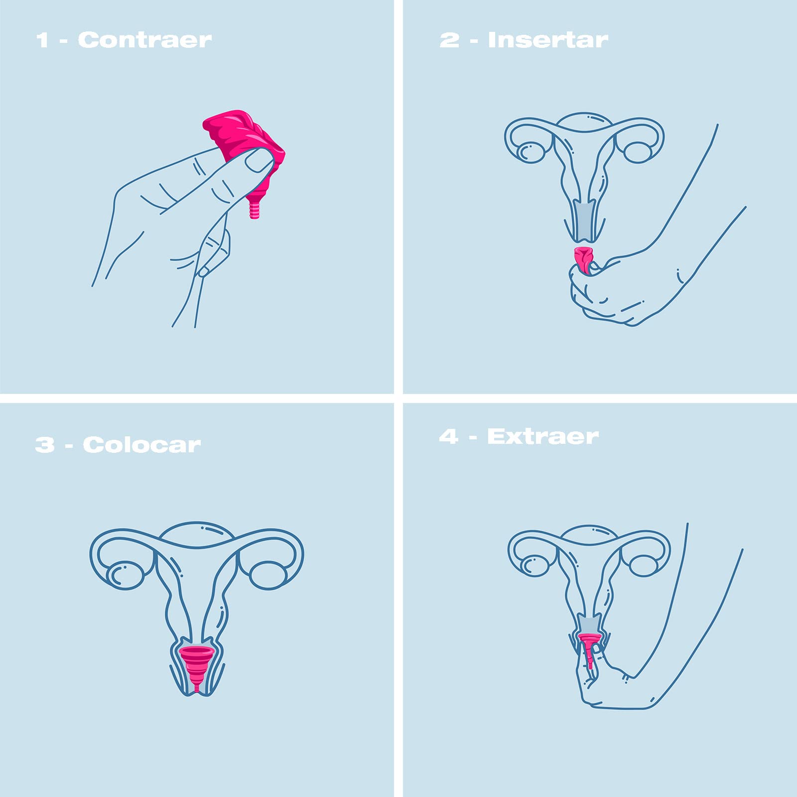 INTIMINA Lily Cup Compact Talla A: Copa Menstrual Pequeña con Diseño Compacto Plegable para Fujo Ligero o Medio. Una de las Mejores Copas Menstruales