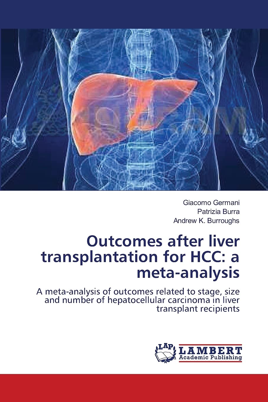 Outcomes after liver transplantation for HCC: a meta-analysis: A meta-analysis of outcomes related to stage, size and number of hepatocellular carcinoma in liver transplant recipients