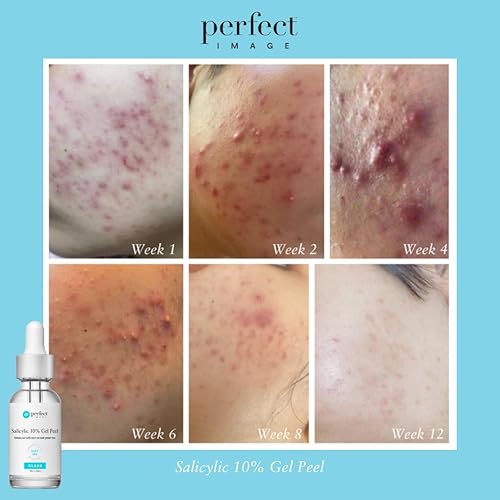 Miniatura 7 de Salicylic 10% Gel Peel, Breakout and Pore Minimizer and Cleanser, 15-30 Full Facial Chemical Peels, 1 fl oz. e, 30 mL – Perfect Image 10% de fuerza