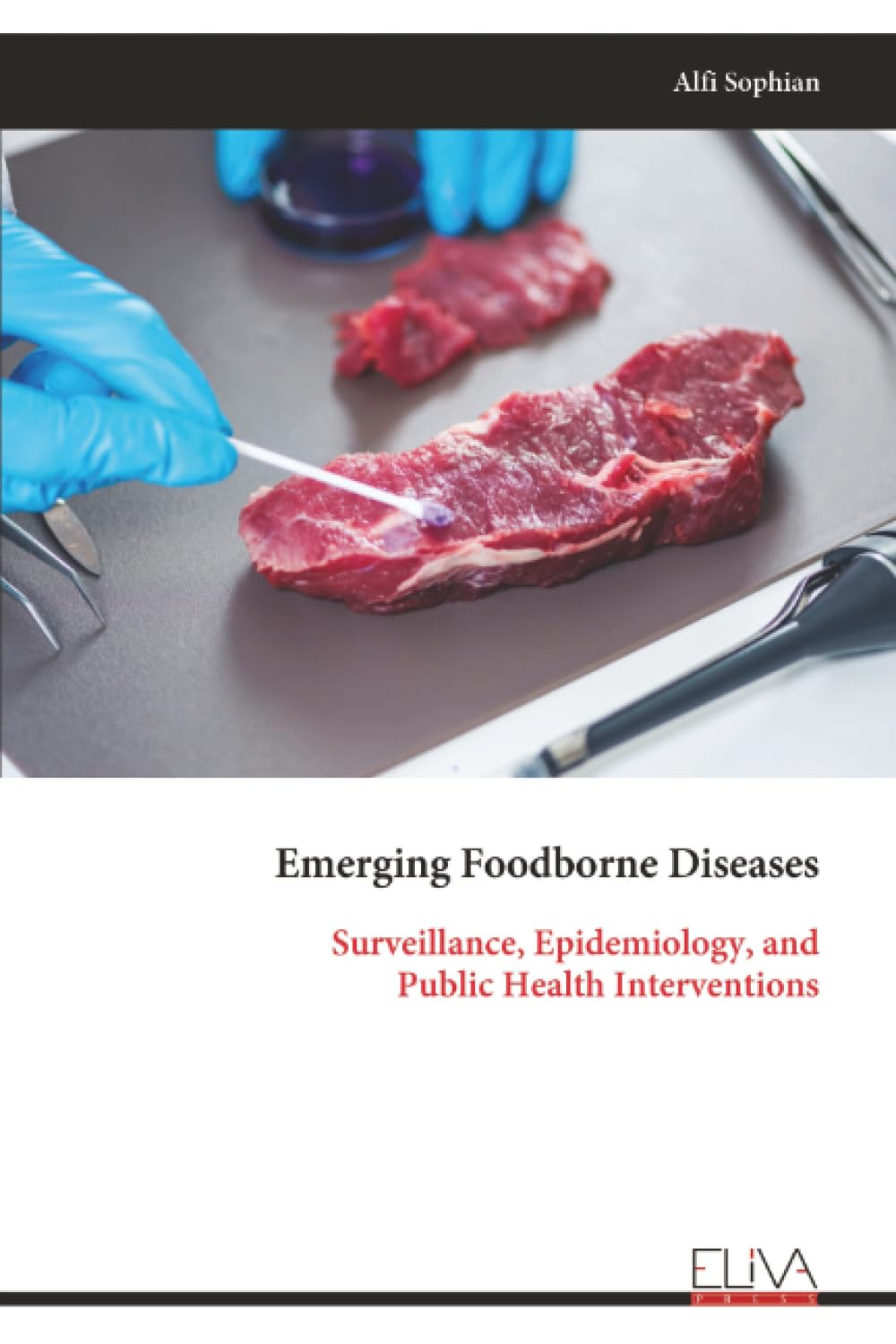 Emerging Foodborne Diseases: Surveillance, Epidemiology, and Public Health Interventions