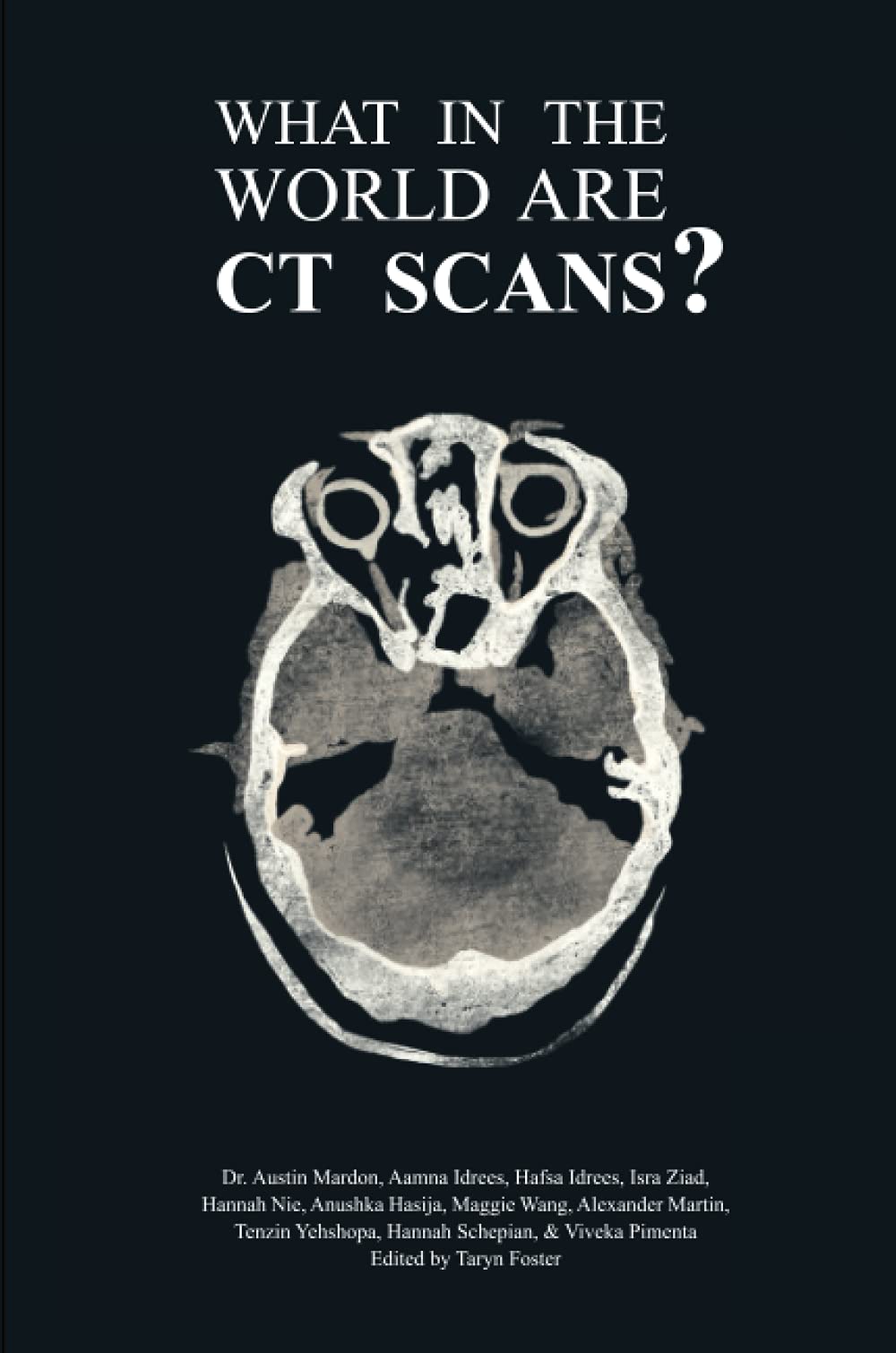 What in the World are CT Scans?