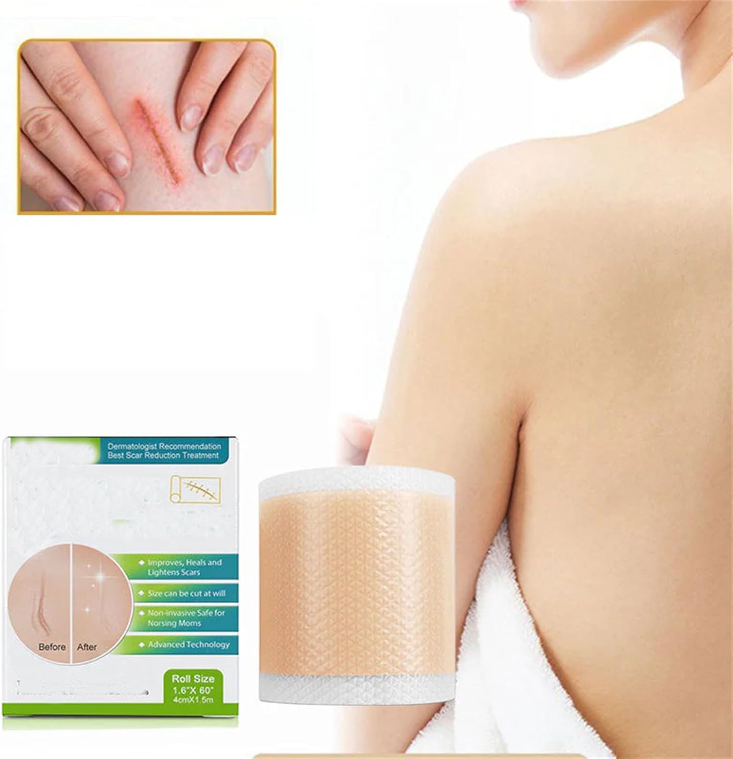 Silicone Wound Decrease Scar Patches,Self-Adhesive Silicone Patch,Smooth Skin Care Patch (5Pcs)
