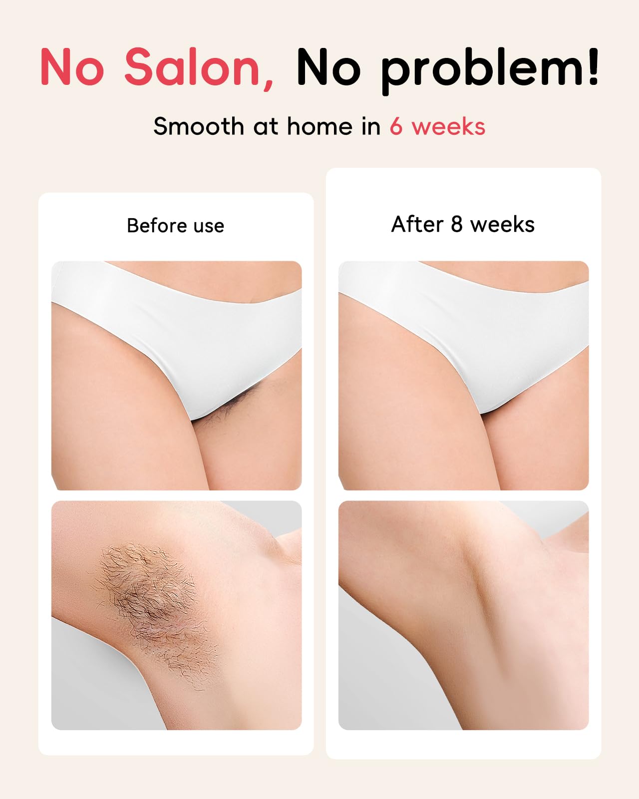 Haarlosy IPL Geräte Haarentfernung - 22J Schmerzfreie Laser Haarentfernungsgerät Ideal für Zuhause, Geeignet für Damen Herren am Körper, Gesicht, Achseln, Beinen