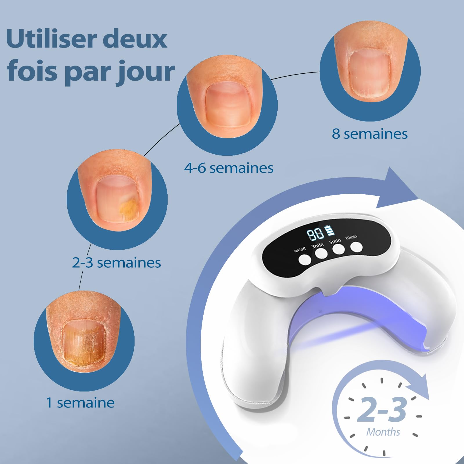 Laser Mycose Ongle Pied - Appareil Mycose Ongle Pied avec Laser Ongle à Doubles Longueurs d’Onde et Affichage de l’Heure pour le Traitement d’Appoint de la Mycose Ongles des Pieds, Blanc
