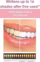 Vista 2 de Novashine Kit profesional de blanqueamiento de dientes: luz LED azul avanzada, gel de peróxido concentrado, adaptador para teléfono inteligente