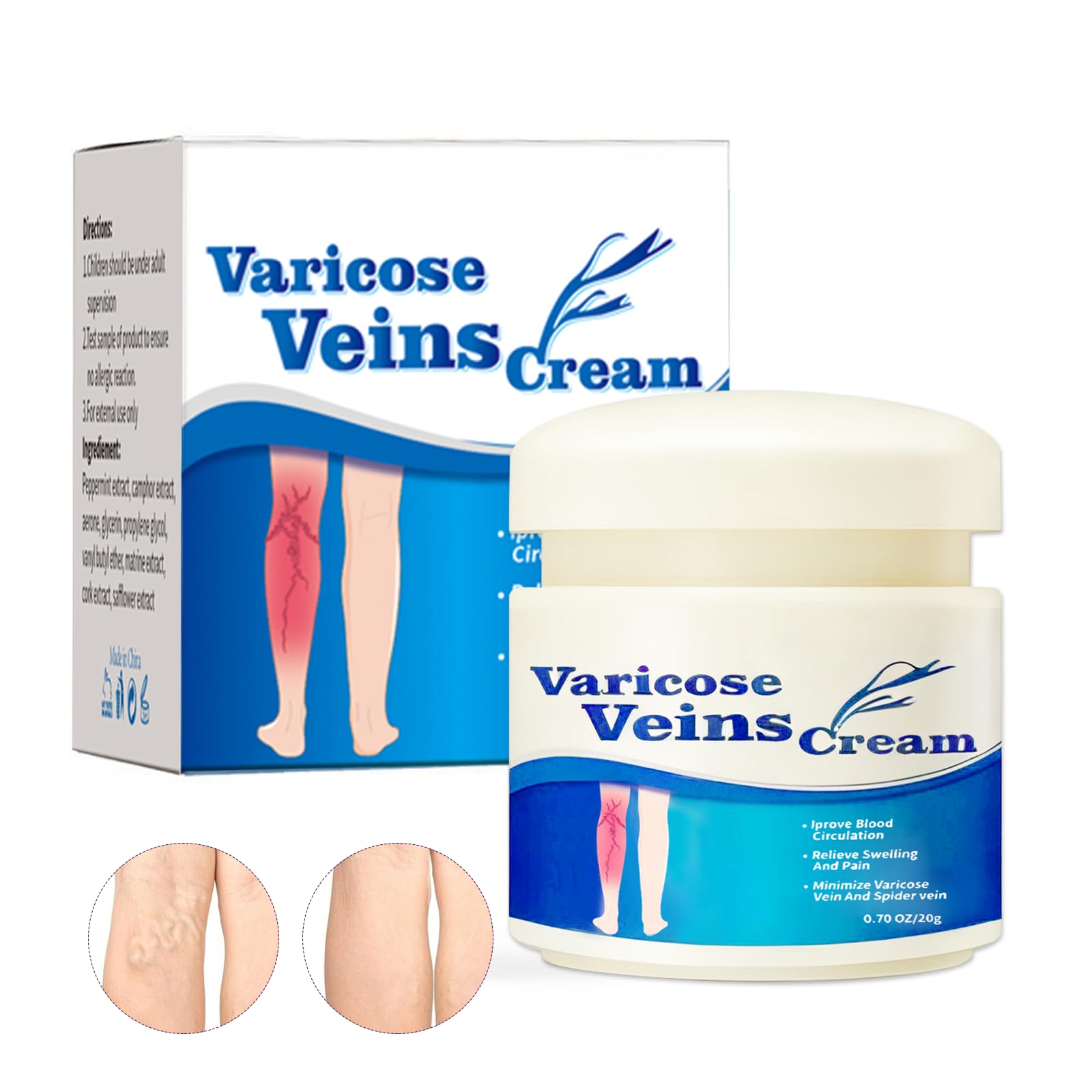 20g Crème pour Les Varices,Soulage Rapidement Les Jambes Fatiguées Et Lourdes,Facile à Utiliser