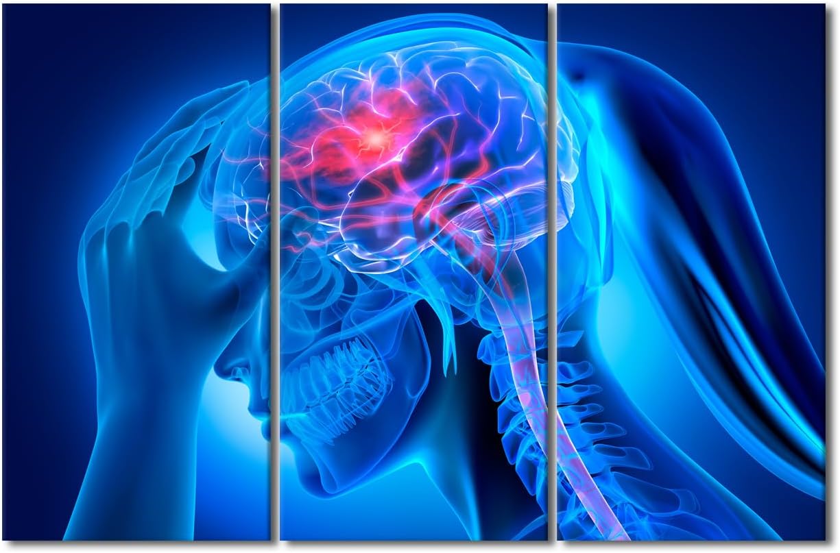 Brain Stroke 3D Posters Prints Painting Office Decor 3 Panel Vintage Wall Art Anatomy Concept X- Ray Female Head with Brain Stroke Pictures Artwork Posters and Prints Framed Ready to Hang 40"Wx60"H 60x40 in 3PANEL-21