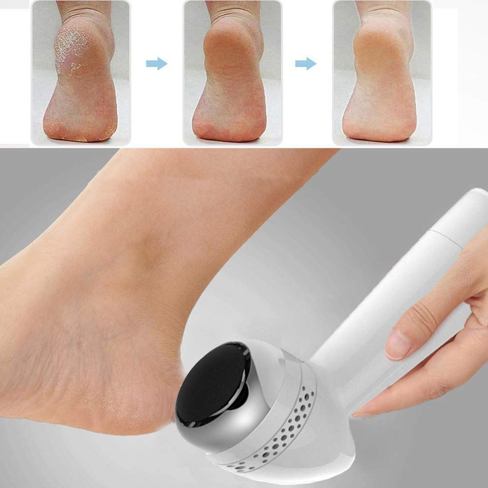 Herramienta de pedicura removedor de Callos eléctrico, removedor de Piel Dura de pedicura de pies Cuidado de pies portátil con vacío para Grietas muertas, raspador de pies,A (B)