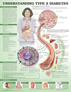 Understanding Type 2 Diabetes Anatomical Chart
