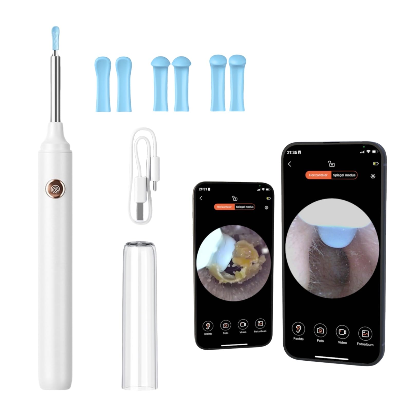 miluna pro - intelligenter ohrenreiniger mit hd-kamera Intelligenter Ohrenreiniger mit HD-Kamera – Effizienter Ohrenschmalz Entferner und Ohrenschmalz-Sauger für eine gründliche Ohrenreinigung