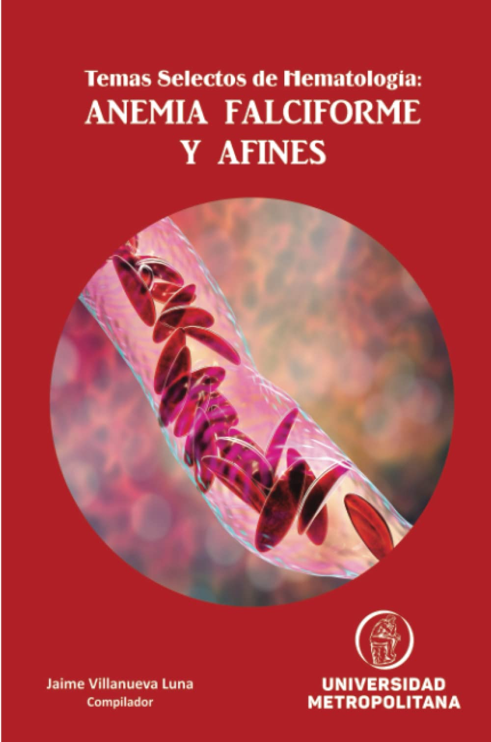 Temas Selectos de Hematología: ANEMIA FALCIFORME Y AFINES