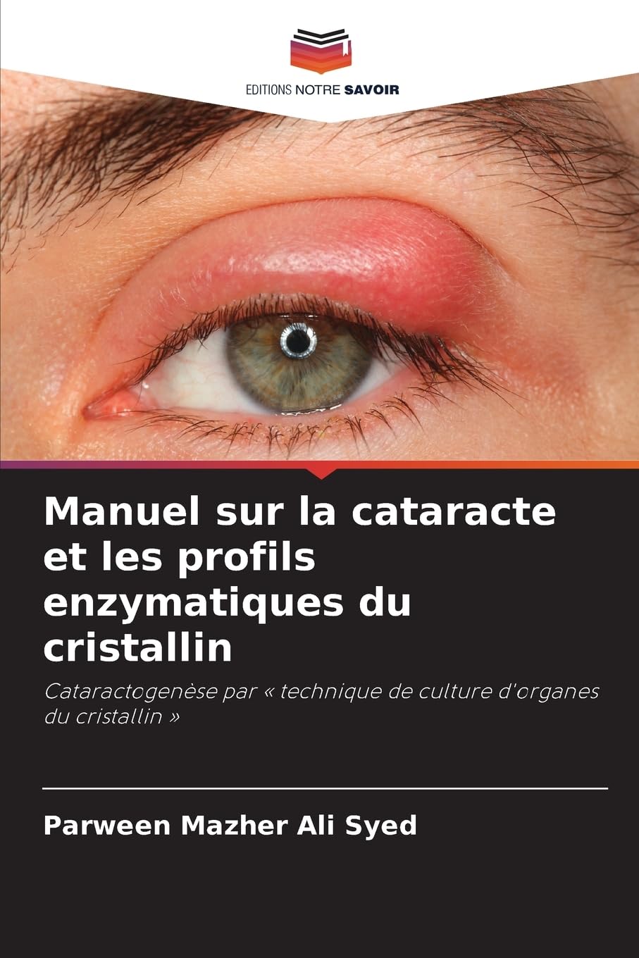 Manuel sur la cataracte et les profils enzymatiques du cristallin: Cataractogenèse par « technique de culture d'organes du cristallin »