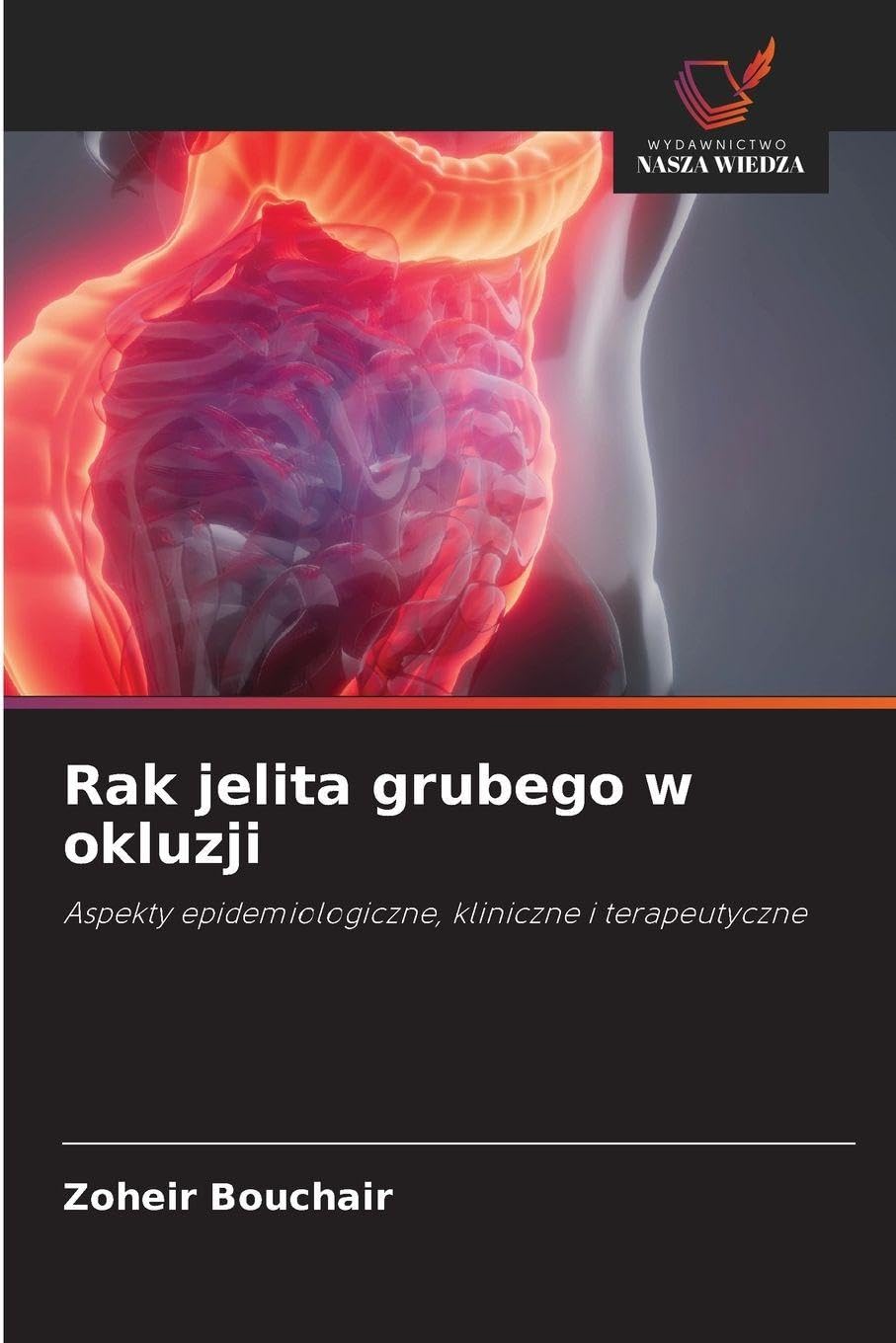 Rak jelita grubego w okluzji: Aspekty epidemiologiczne, kliniczne i terapeutyczne