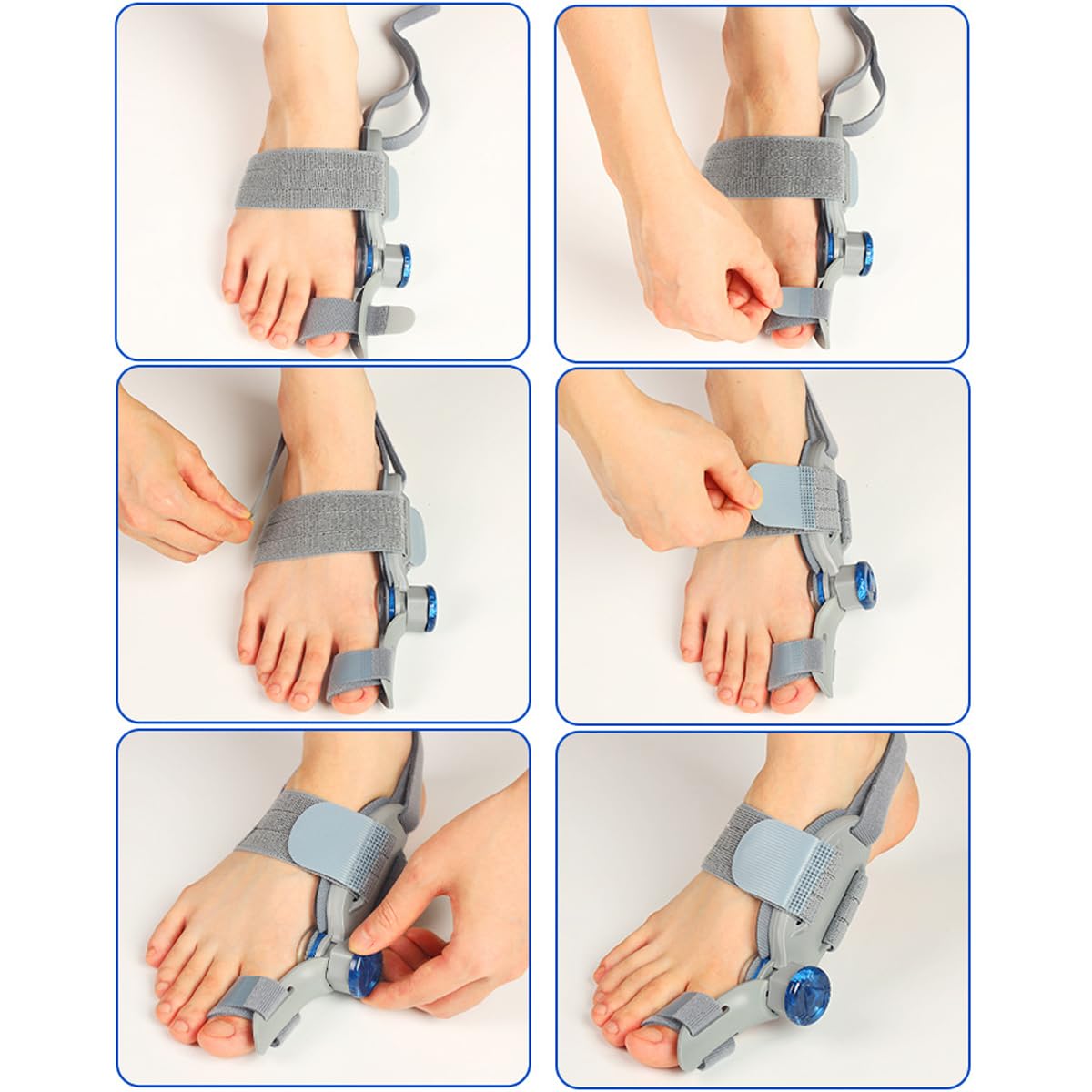 Correttore per alluce valgo da donna con cinturino antiscivolo per tallone, tutore per alluce valgo, universale per piedi sinistro e destro, efficace sollievo dal dolore e supporto