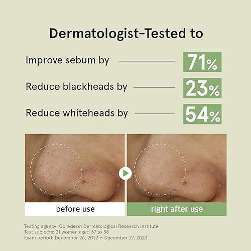 Miniatura 5 de ONE THING Limpiador de puntos negros de hamamelis, 3.38 onzas líquidas. Desobstruye los poros, paquete exfoliante no irritante, tiras de poros