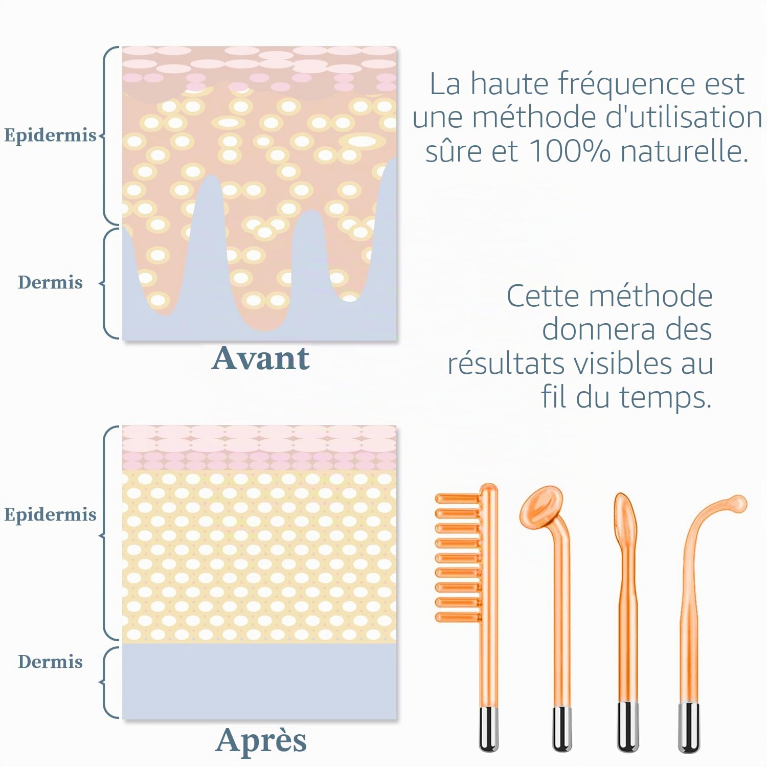 Appareil Haute Frequence Esthetique - TUMAKOU Appareil Visage Avec 4 Electrodes pour Soins pour le Visage - Pour l'acné, le Raffermissement et les Rides | Avec 4 Electrodes pour Soins pour le Visage - Pour l'acné, le Raffermissement et les Rides