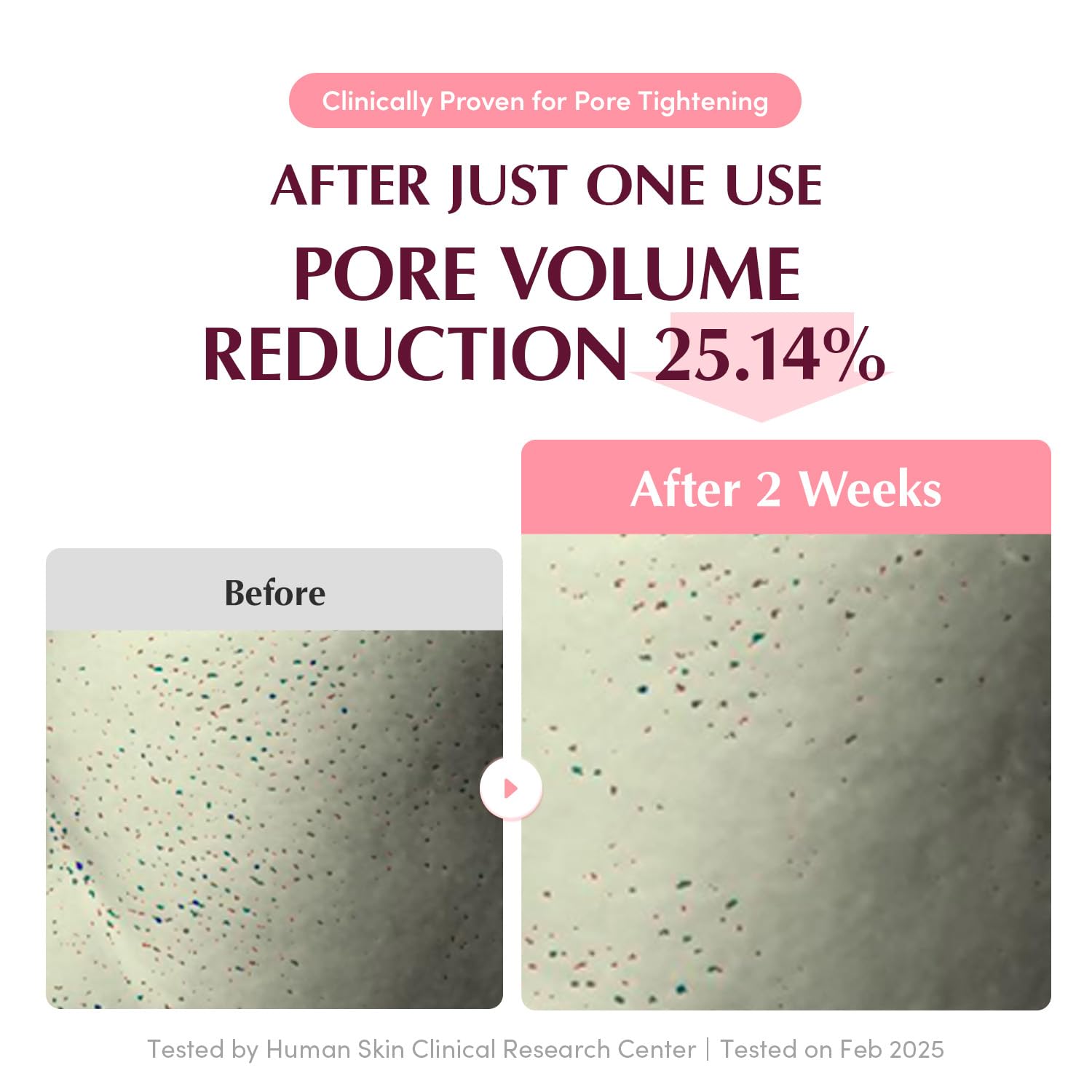 - Collagen Pore-Tight Up Hydrogel Mask (4 adet) - Vegan PDRN + Kolajen Hydrojel Maske
