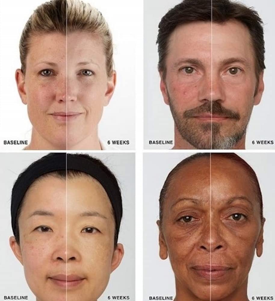 Red Light Therapy for Face LED Face Mask for Eyes, Neck & Skin | Infrared Therapy Mask for Anti-Aging, Wrinkles, Skin Rejuvenation (HSA/FSA Eligible*)