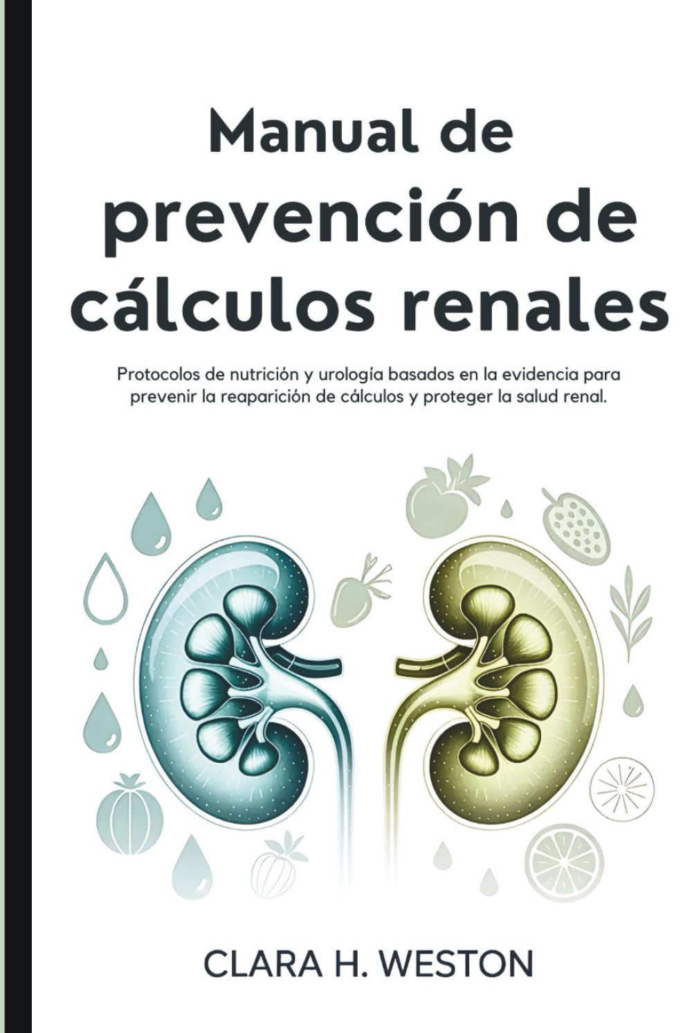 Manual de prevención de cálculos renales: Protocolos de nutrición y urología basados en la evidencia para prevenir la reaparición de cálculos y proteger la salud renal.