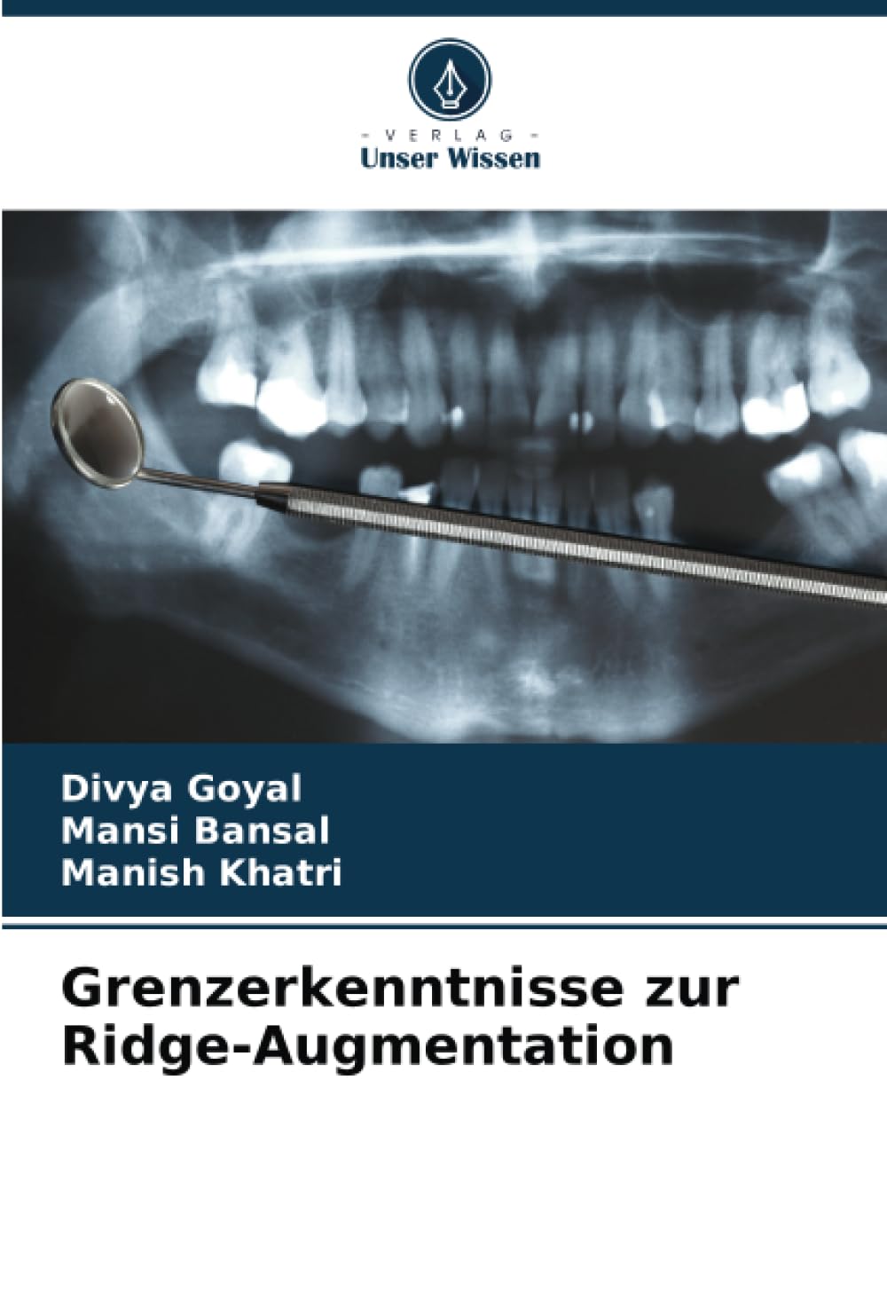 Grenzerkenntnisse zur Ridge-Augmentation